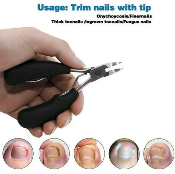 （50%OFF TODAY）  Medical-Grade Nail Clippers - Image 7
