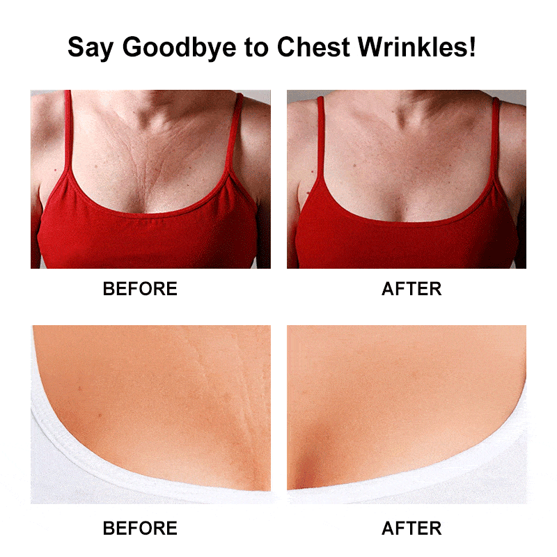 Anti Wrinkle-Reusable Silicone Care Chest Pad - Image 6