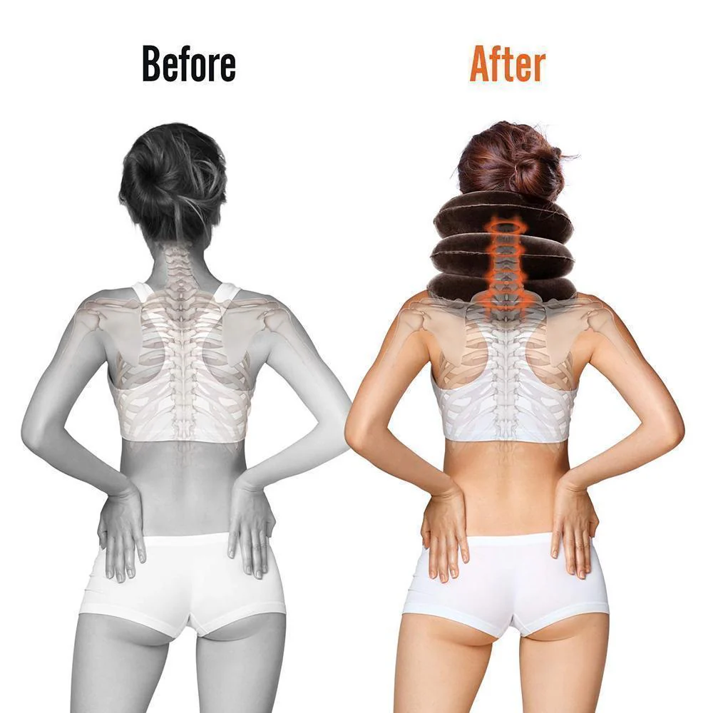 Cervical Traction Device, Inflatable Neck Support - Image 4