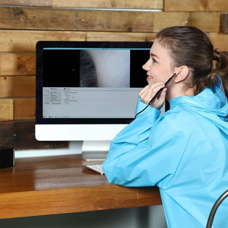 Wireless Ear Otoscope Inspection Camera - Image 3